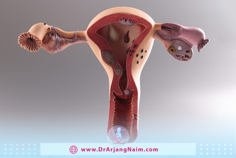 Fallopian Tubes