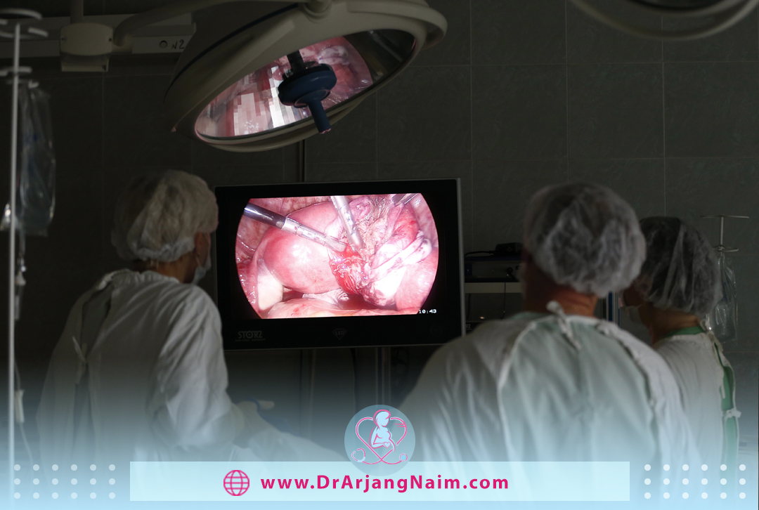 abdominal laparoscopy performed