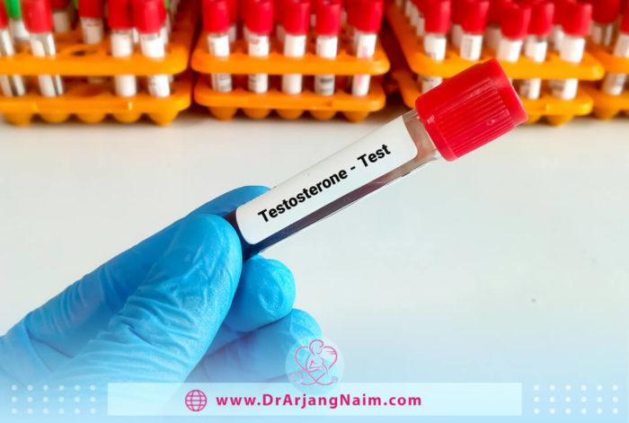 Diagnosis of low testosterone