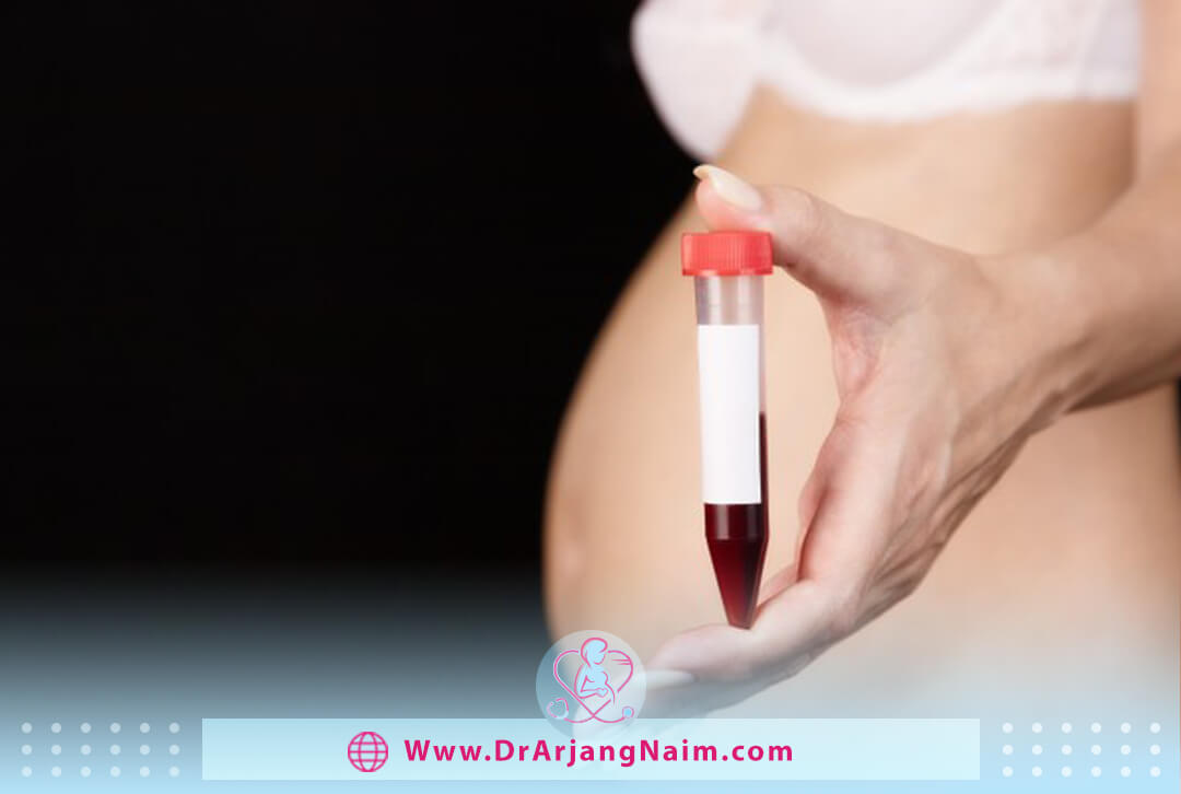 Gestational diabetes Diagnosis