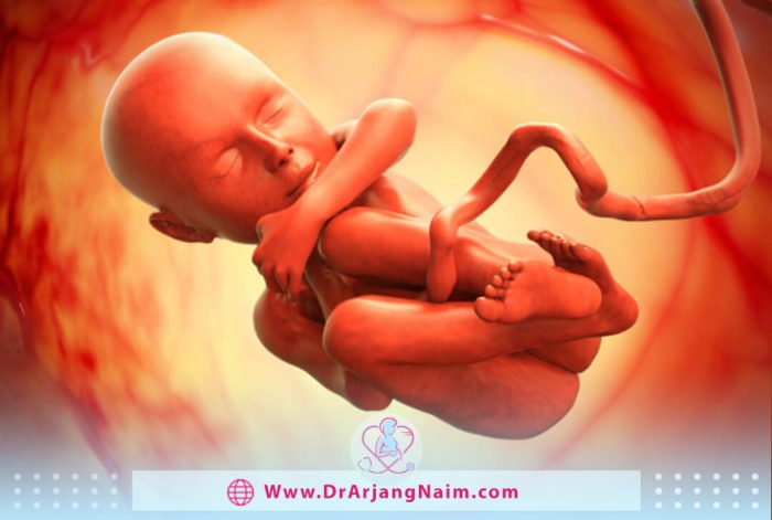 Information about placental abruption