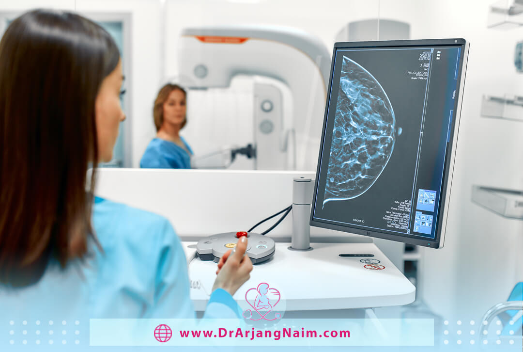 Mammogram