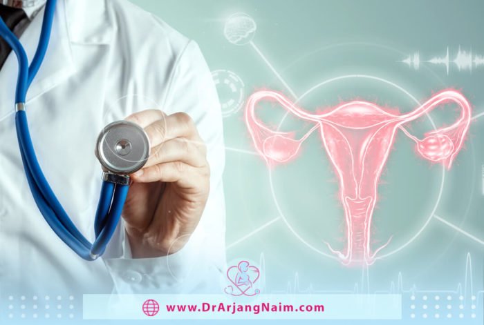 Ruptured ovarian cyst symptoms