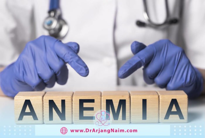 What Is Iron-Deficiency Anemia