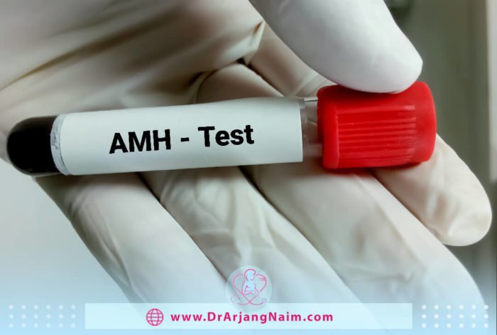 What is AMH in the diminished ovarian reserve