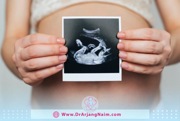 What is Oligohydramnios in pregnancy