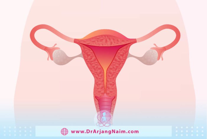 What is a uterine septum