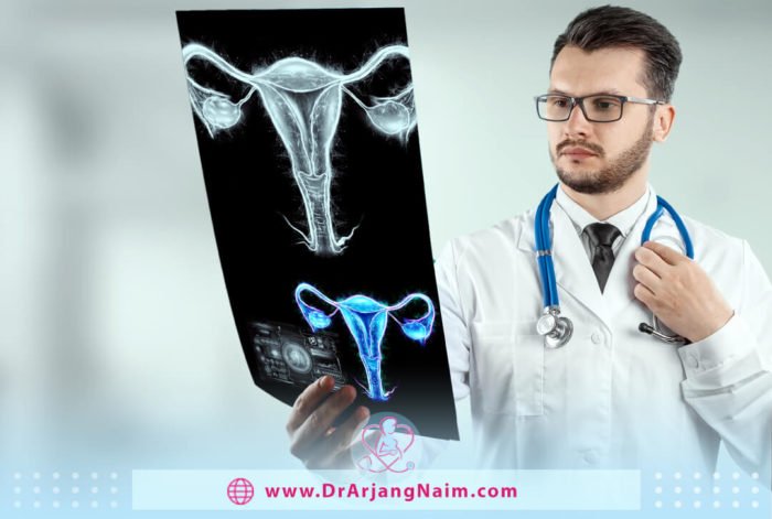 What is ovarian torsion - Dr. arjang naim