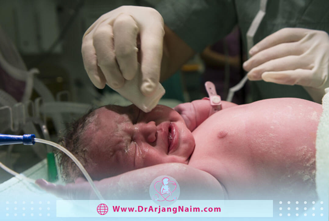 What steps should you take to choose Lotus Birth