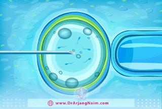 What is IVF?