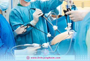 Laparoscopic surgery