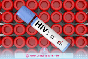 HIV antibody test