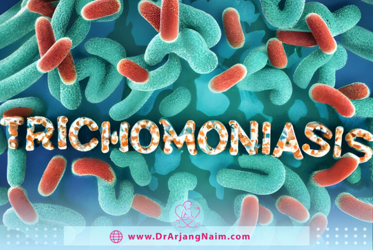 Trichomoniasis