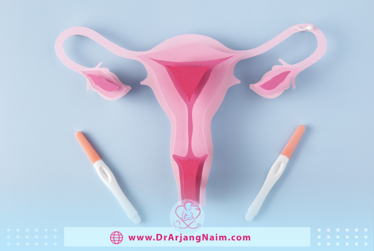 Blocked Fallopian Tubes